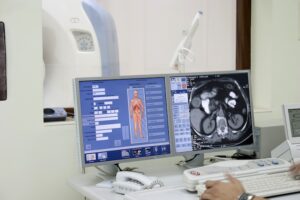 machine learning e imaging iperspettrale tumori
